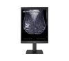 Foto de Monitor Medico LG 22" Diagnstico 5MP 4:5 (21HQ613D-B)