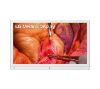 Foto de Monitor Mdico LG 27" Quirrgico UHD 12G-SDI 27HS714S-W